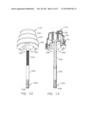 Surgical Access Device with Adjustable Cannula diagram and image