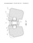 MEDICAL ARTICLE SECUREMENT DEVICE diagram and image