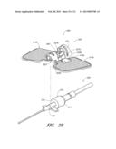 MEDICAL ARTICLE SECUREMENT DEVICE diagram and image