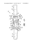 CLOTH DIAPER diagram and image