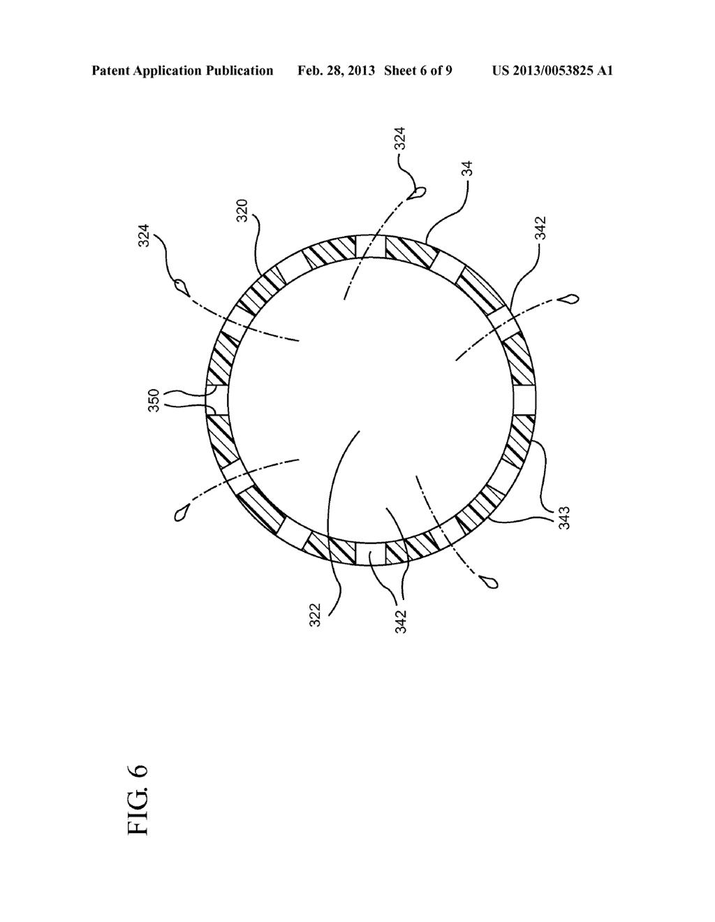 CATHETER HAVING A PRESSURE ACTIVATED SPLITTABLE FEATURE - diagram, schematic, and image 07