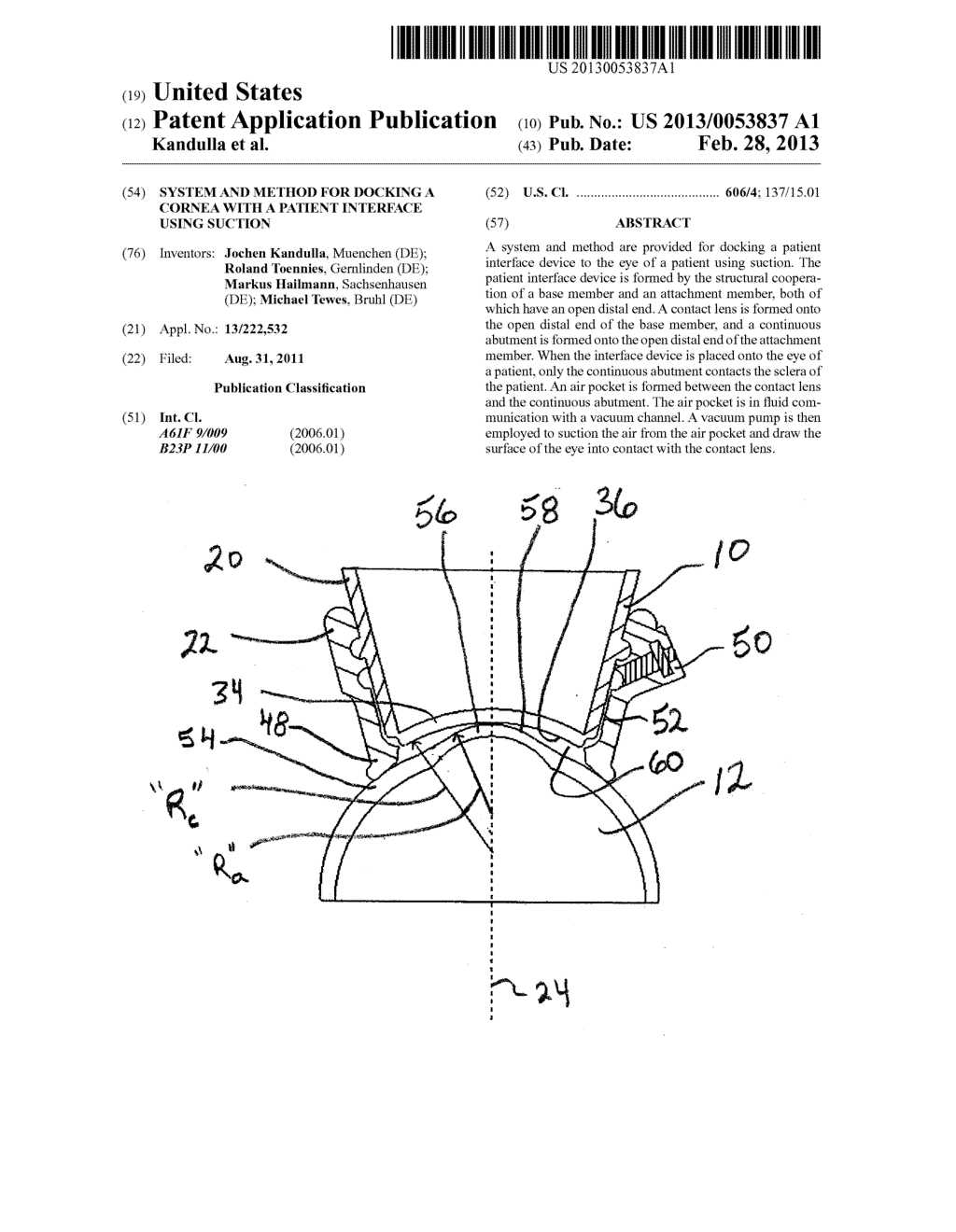 System and Method for Docking a Cornea with a Patient Interface Using     Suction - diagram, schematic, and image 01