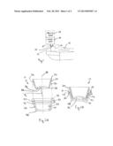 System and Method for Docking a Cornea with a Patient Interface Using     Suction diagram and image