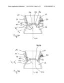 System and Method for Docking a Cornea with a Patient Interface Using     Suction diagram and image