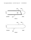 INTERVENTIONAL RADIOLOGIC DEVICES AND METHODS FOR EMBEDDED FILTER REMOVAL diagram and image