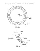 INTERVENTIONAL RADIOLOGIC DEVICES AND METHODS FOR EMBEDDED FILTER REMOVAL diagram and image