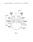 ACCESS AND TISSUE MODIFICATION SYSTEMS AND METHODS diagram and image