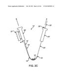 ACCESS AND TISSUE MODIFICATION SYSTEMS AND METHODS diagram and image