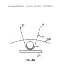 ACCESS AND TISSUE MODIFICATION SYSTEMS AND METHODS diagram and image