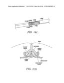 ACCESS AND TISSUE MODIFICATION SYSTEMS AND METHODS diagram and image