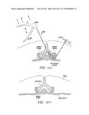 ACCESS AND TISSUE MODIFICATION SYSTEMS AND METHODS diagram and image