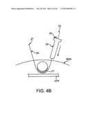 ACCESS AND TISSUE MODIFICATION SYSTEMS AND METHODS diagram and image