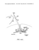 ACCESS AND TISSUE MODIFICATION SYSTEMS AND METHODS diagram and image