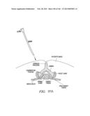 ACCESS AND TISSUE MODIFICATION SYSTEMS AND METHODS diagram and image