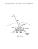 ACCESS AND TISSUE MODIFICATION SYSTEMS AND METHODS diagram and image