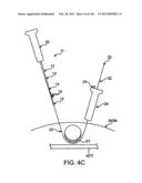 ACCESS AND TISSUE MODIFICATION SYSTEMS AND METHODS diagram and image