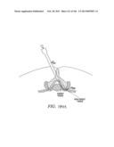 ACCESS AND TISSUE MODIFICATION SYSTEMS AND METHODS diagram and image