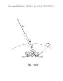 ACCESS AND TISSUE MODIFICATION SYSTEMS AND METHODS diagram and image