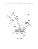 ACCESS AND TISSUE MODIFICATION SYSTEMS AND METHODS diagram and image