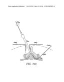 ACCESS AND TISSUE MODIFICATION SYSTEMS AND METHODS diagram and image