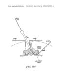 ACCESS AND TISSUE MODIFICATION SYSTEMS AND METHODS diagram and image