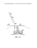 ACCESS AND TISSUE MODIFICATION SYSTEMS AND METHODS diagram and image