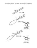 ACCESS AND TISSUE MODIFICATION SYSTEMS AND METHODS diagram and image