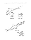 ACCESS AND TISSUE MODIFICATION SYSTEMS AND METHODS diagram and image