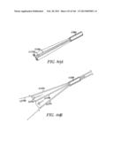 ACCESS AND TISSUE MODIFICATION SYSTEMS AND METHODS diagram and image