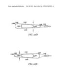 ACCESS AND TISSUE MODIFICATION SYSTEMS AND METHODS diagram and image