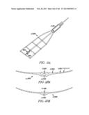 ACCESS AND TISSUE MODIFICATION SYSTEMS AND METHODS diagram and image