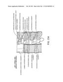 ACCESS AND TISSUE MODIFICATION SYSTEMS AND METHODS diagram and image