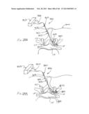 ACCESS AND TISSUE MODIFICATION SYSTEMS AND METHODS diagram and image