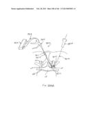 ACCESS AND TISSUE MODIFICATION SYSTEMS AND METHODS diagram and image