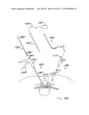 ACCESS AND TISSUE MODIFICATION SYSTEMS AND METHODS diagram and image