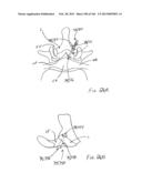 ACCESS AND TISSUE MODIFICATION SYSTEMS AND METHODS diagram and image