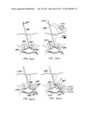 ACCESS AND TISSUE MODIFICATION SYSTEMS AND METHODS diagram and image