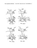 ACCESS AND TISSUE MODIFICATION SYSTEMS AND METHODS diagram and image