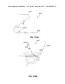 ACCESS AND TISSUE MODIFICATION SYSTEMS AND METHODS diagram and image