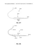 ACCESS AND TISSUE MODIFICATION SYSTEMS AND METHODS diagram and image