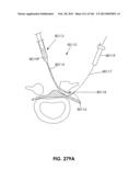 ACCESS AND TISSUE MODIFICATION SYSTEMS AND METHODS diagram and image