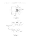 ACCESS AND TISSUE MODIFICATION SYSTEMS AND METHODS diagram and image