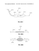 ACCESS AND TISSUE MODIFICATION SYSTEMS AND METHODS diagram and image