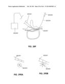 ACCESS AND TISSUE MODIFICATION SYSTEMS AND METHODS diagram and image