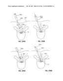 ACCESS AND TISSUE MODIFICATION SYSTEMS AND METHODS diagram and image