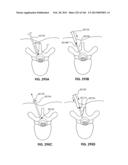 ACCESS AND TISSUE MODIFICATION SYSTEMS AND METHODS diagram and image