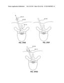 ACCESS AND TISSUE MODIFICATION SYSTEMS AND METHODS diagram and image