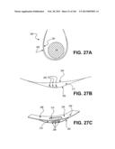 ACCESS AND TISSUE MODIFICATION SYSTEMS AND METHODS diagram and image