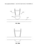 ACCESS AND TISSUE MODIFICATION SYSTEMS AND METHODS diagram and image