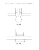 ACCESS AND TISSUE MODIFICATION SYSTEMS AND METHODS diagram and image